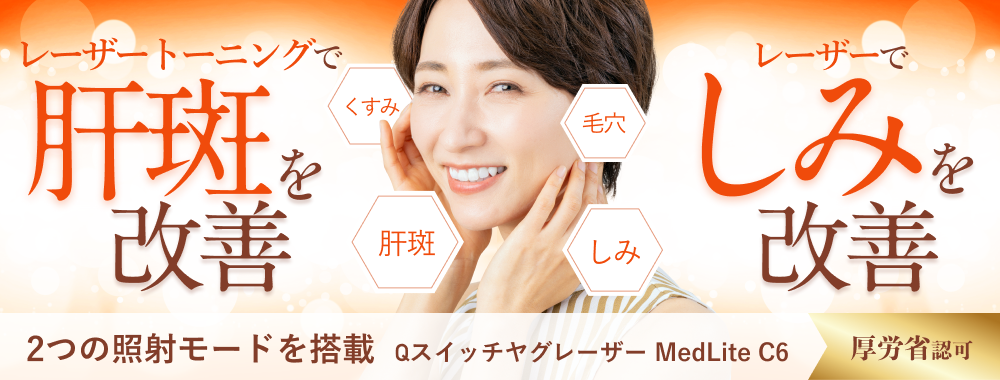 QスイッチヤグレーザーメドライトC6（レーザー治療） 肝斑や炎症性色素沈着を安全に治療する　肝斑　しみ　タトゥー 除去　毛穴　くすみ